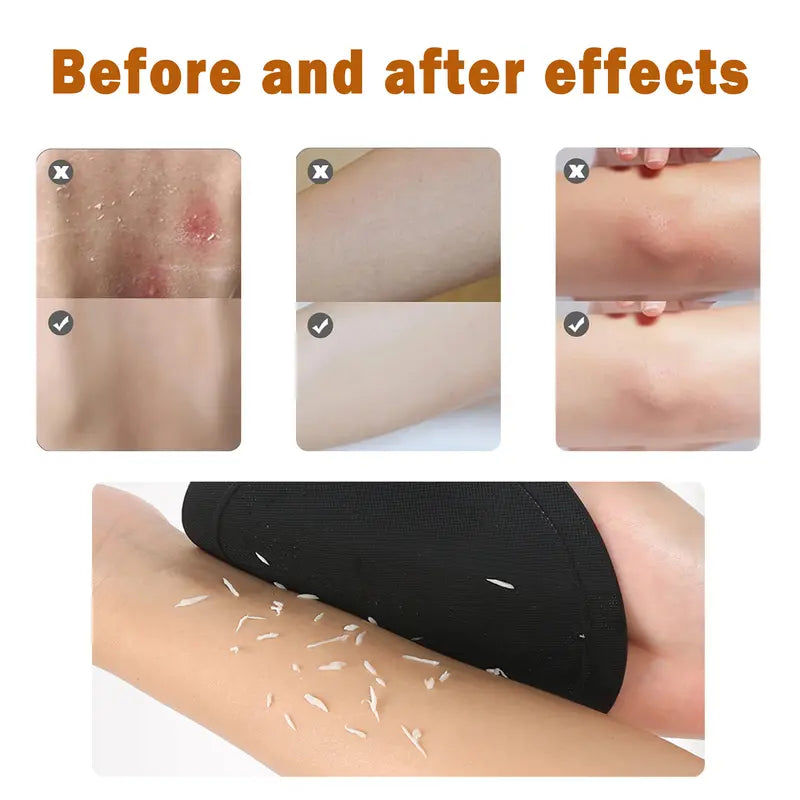 🥳2026 HOT SALE🥳💞50K+ SOLD!🌸🧖‍♀️ 50% OFF!Soft Silicone Shower Scrubber – Gentle Exfoliating Body Brush